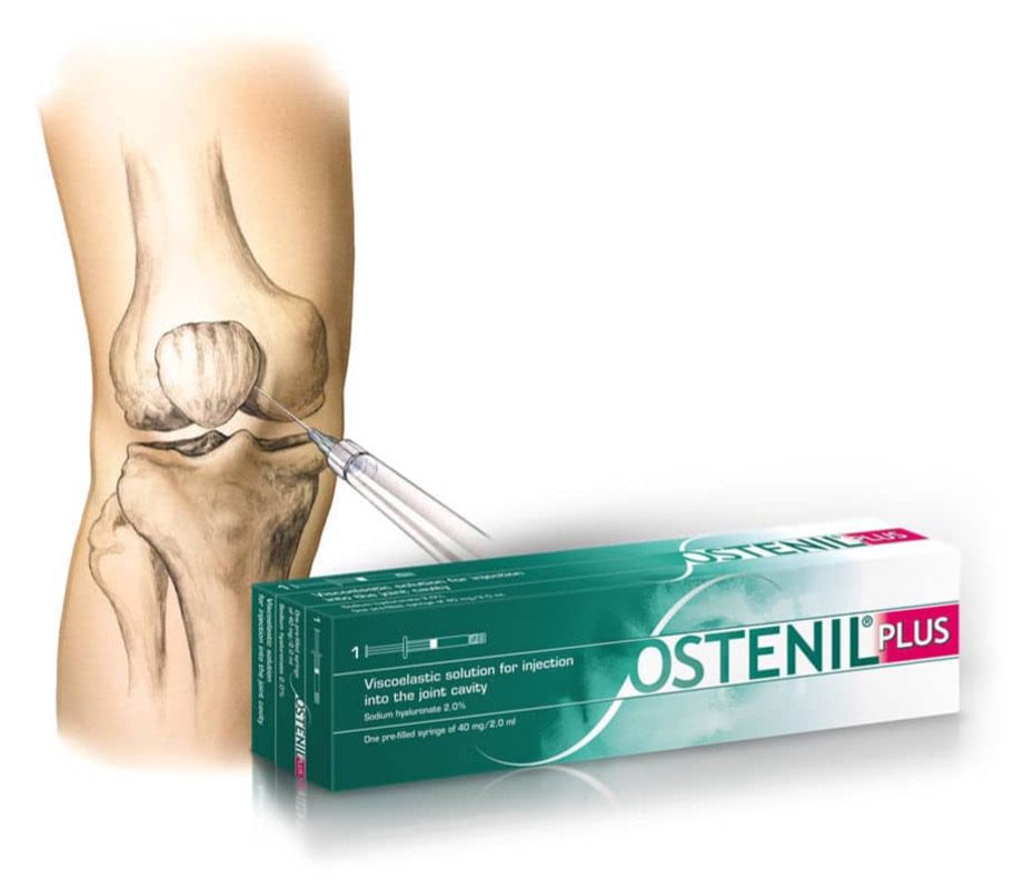hyaluronic acid injection, hyaluronic acid injections, hyaluronic acid injection knee, ostenil plus
